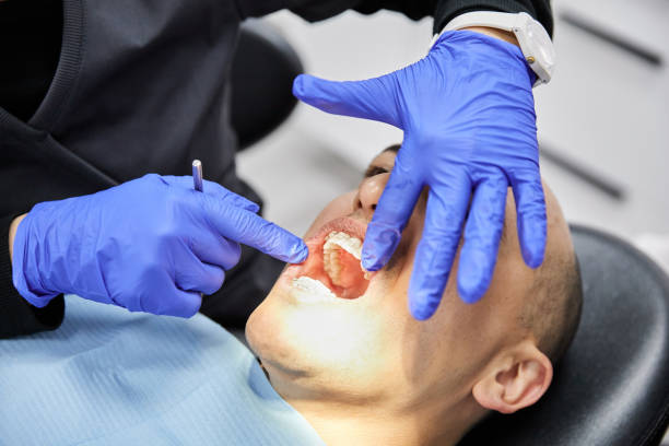 Best Same-Day Emergency Dentist in Gleed, WA